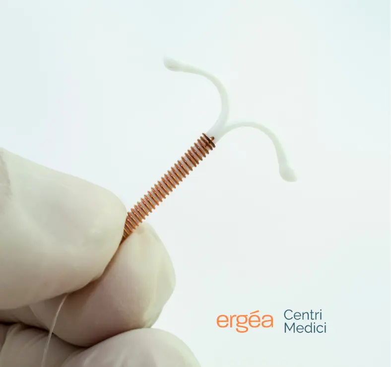 Lo IUD: tutto quello che c’è da sapere sulla spirale contraccettiva  - Ergea